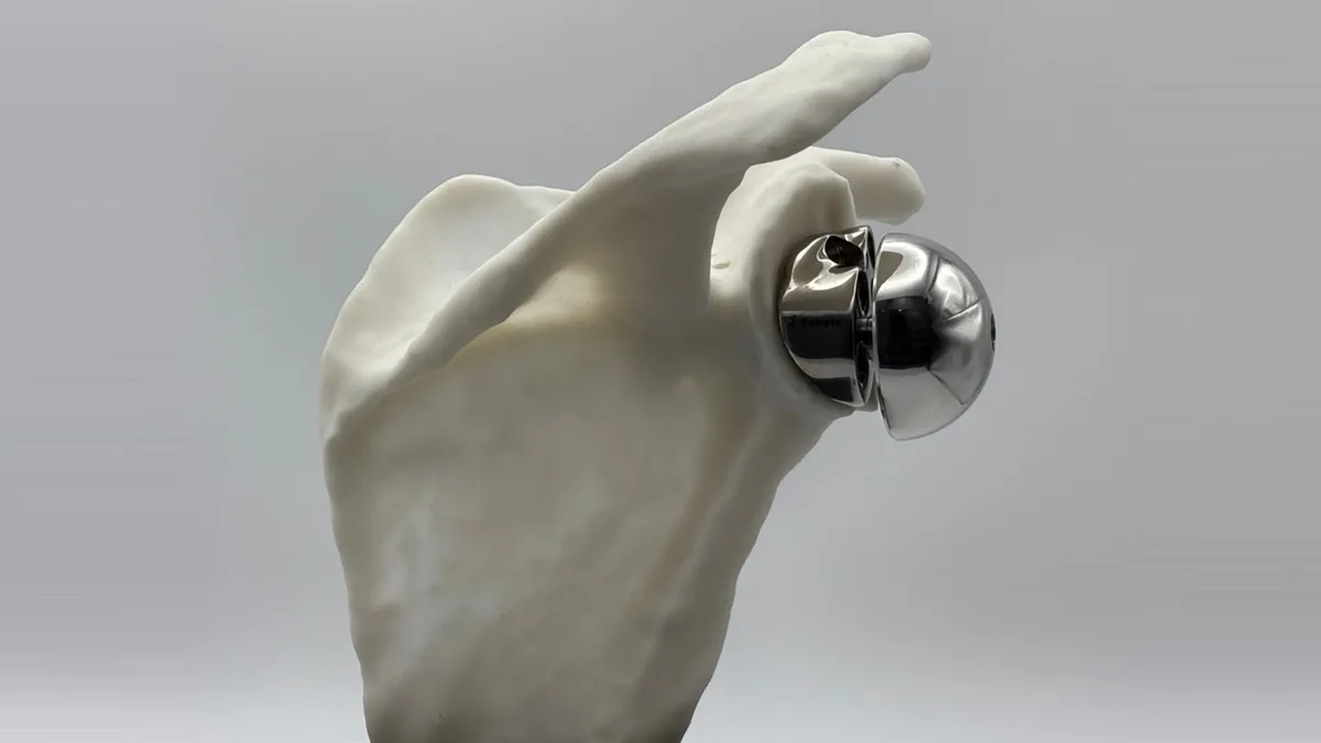 ReGlen patient-specific implant