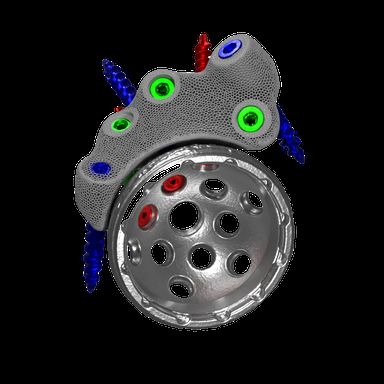 Compression, docking and dome screws working together