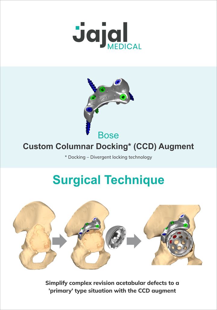 Bose Augment surgical technique, page 1