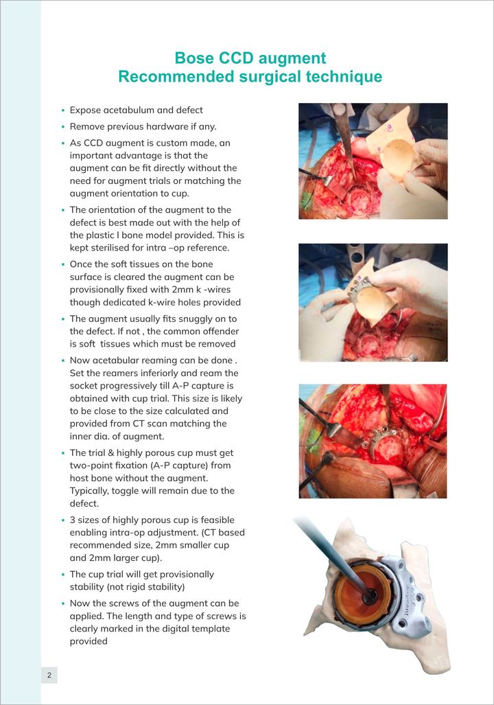 Bose Augment surgical technique, page 2