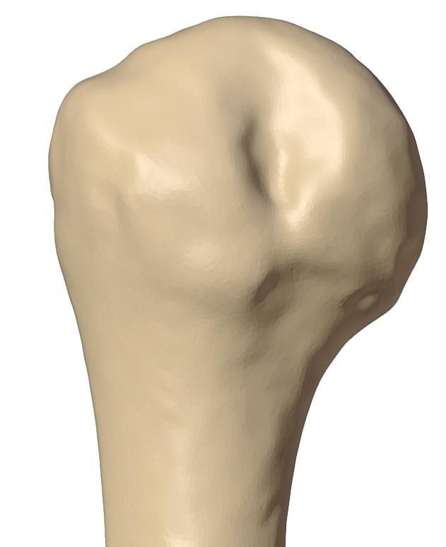 Posterior view of the humeral head defect