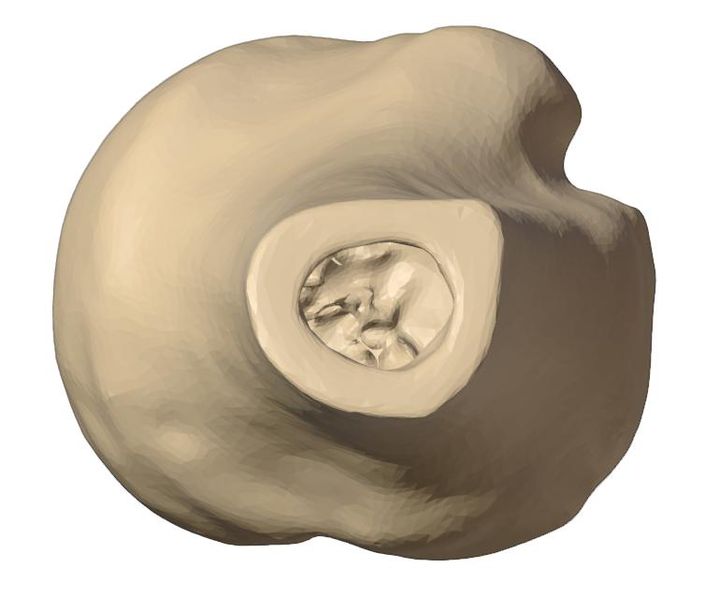 Distal view with the defect dimensions