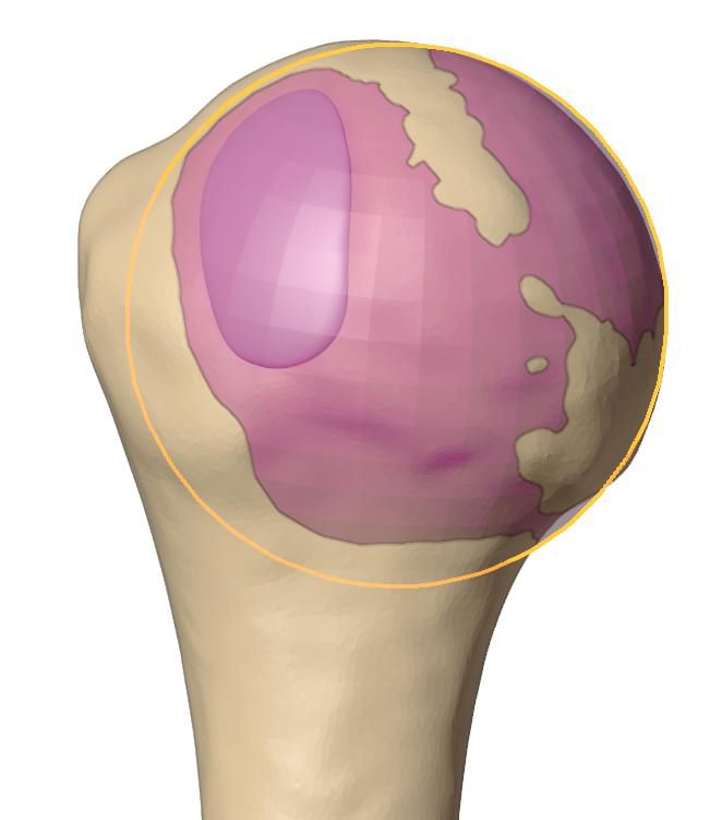 Landmarks A, B and C on the posterior view