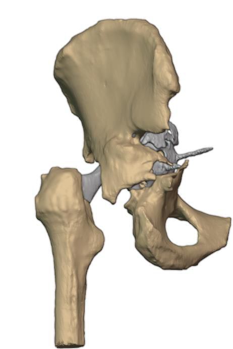 Anterior view