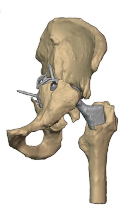 Posterior view