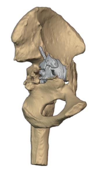 Medial view