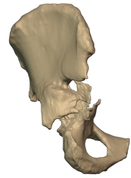 Defect detail, anterior