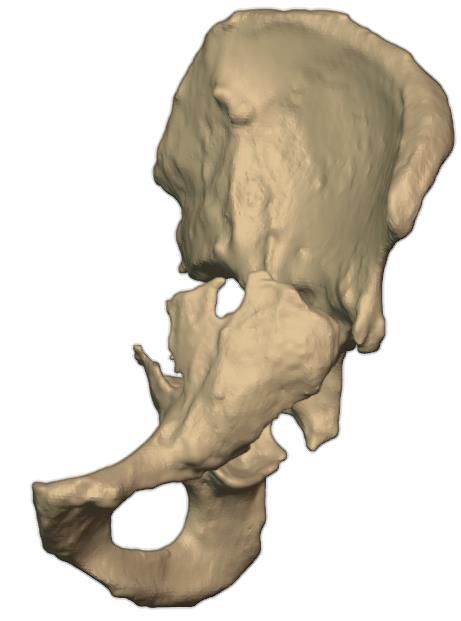 Defect detail, posterior
