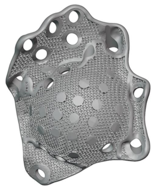 Back view — porous surface and perforation holes