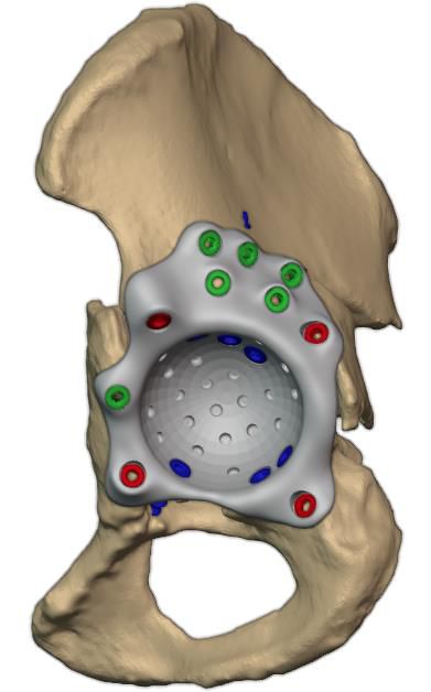 Anterior view