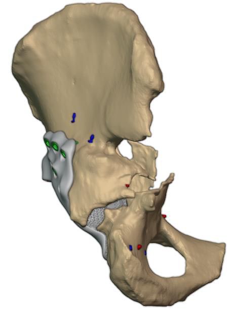 Lateral view