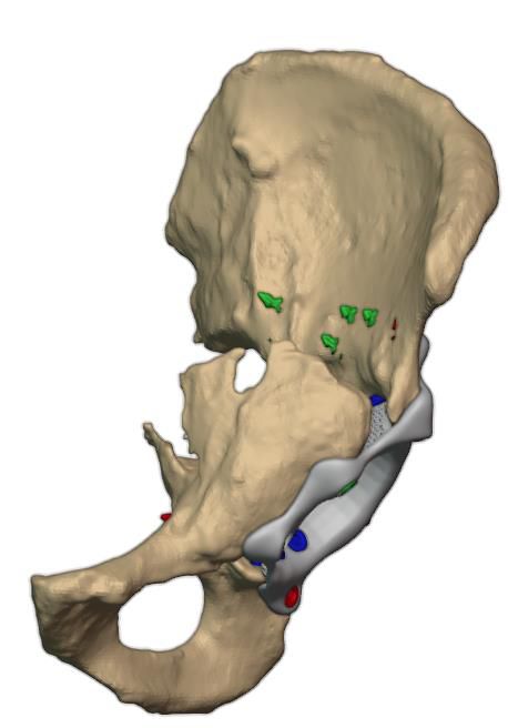 Posterior view