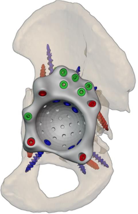 Anterior view
