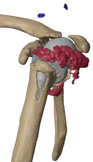 Lateral view