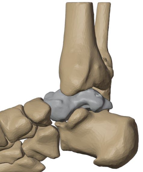 Lateral view