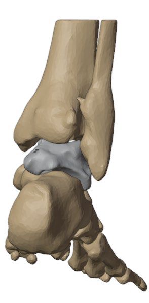 Medial view