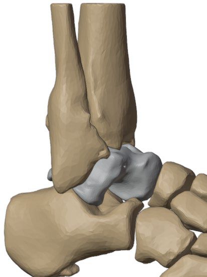 Posterior view