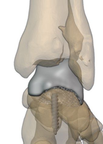 Lateral view