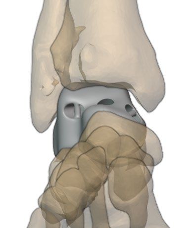Anterior view