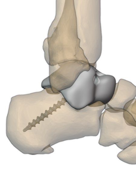 Medial view