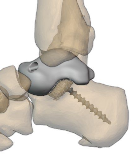 Posterior view