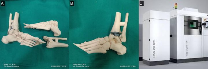 Pre-operative MRI — coronal and sagittal
