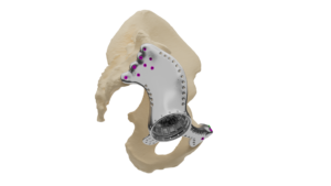 post op Image