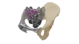 post op Image