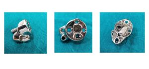 ReGlen Implant for Glenoid Reconstruction