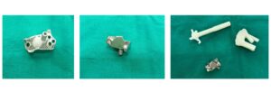 ReGlen - Patient Specific Glenoid Implant.